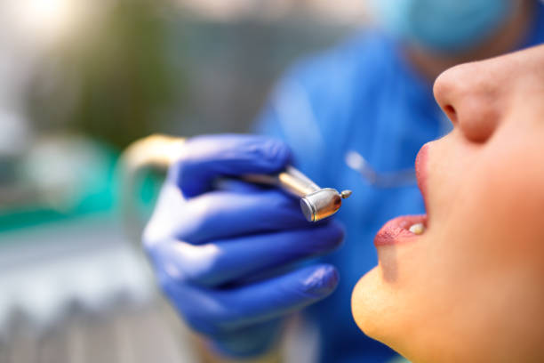 Dental Inlays and Onlays in Vero Beach South, FL